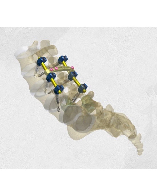  Neptune 5.5 Degenerative
