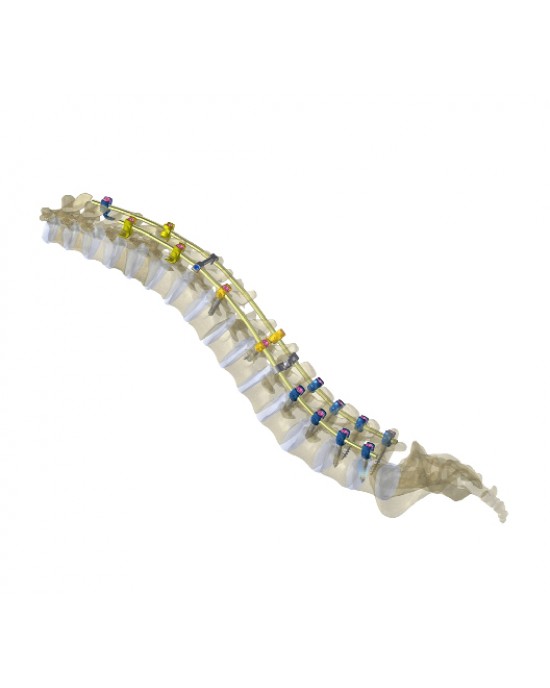 Neptune 5.5 Deformity